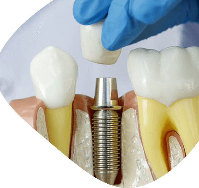 dental cross stomatoloska klinika beograd